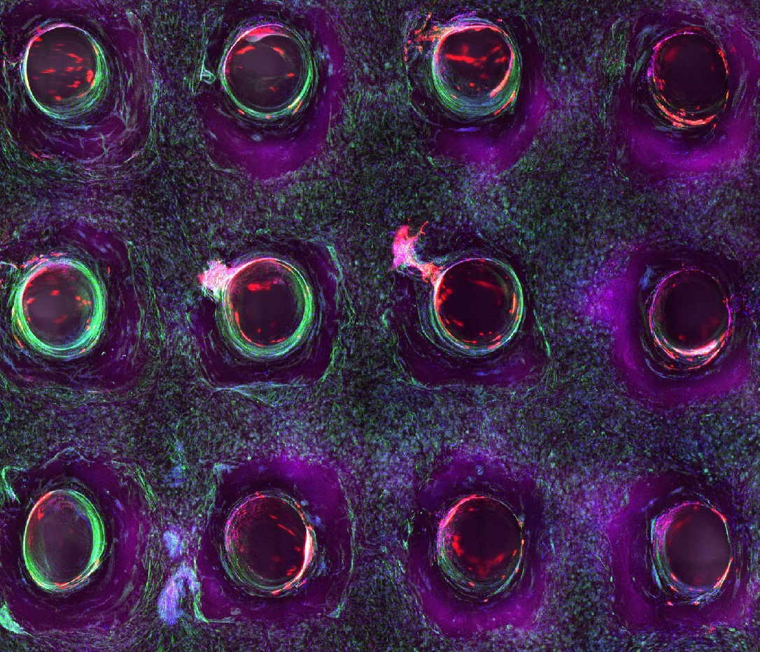 Gambar mikroskop confocal yang menunjukkan cetakan sel induk 3-D yang berdiferensiasi menjadi sel tulang. LEWIS LAB, INSTITUT WYSS, HARVARD UNIVERSITY